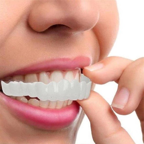 Clip-on Zahnveneers für sofortiges Lächeln oben & unten – Bild 8