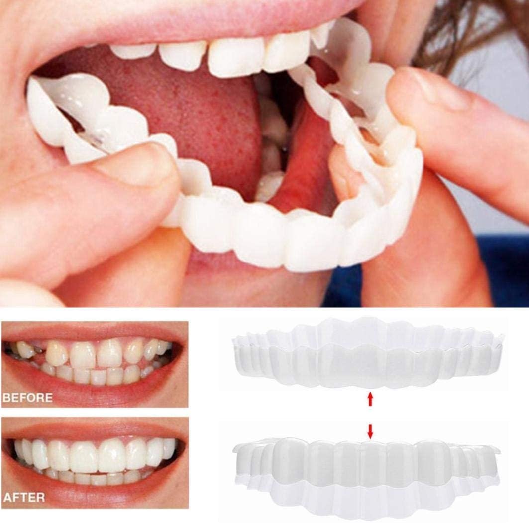 Clip-on Zahnveneers für sofortiges Lächeln oben & unten – Bild 9