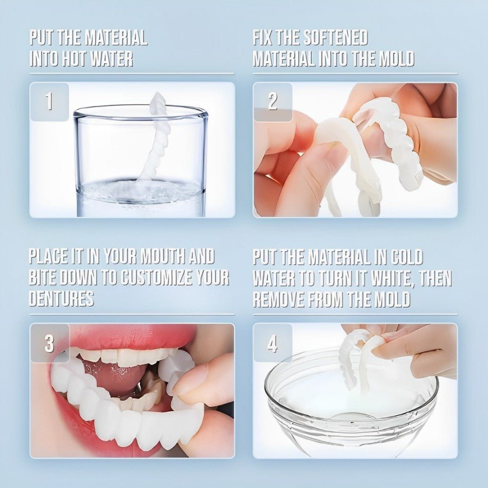 Clip-on Zahnveneers für sofortiges Lächeln oben & unten – Bild 7