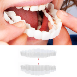 Clip-on Zahnveneers für sofortiges Lächeln oben & unten