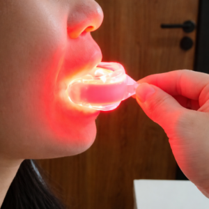 Rotlichttherapiegerät für Zahnfleisch & Zähne 625nm
