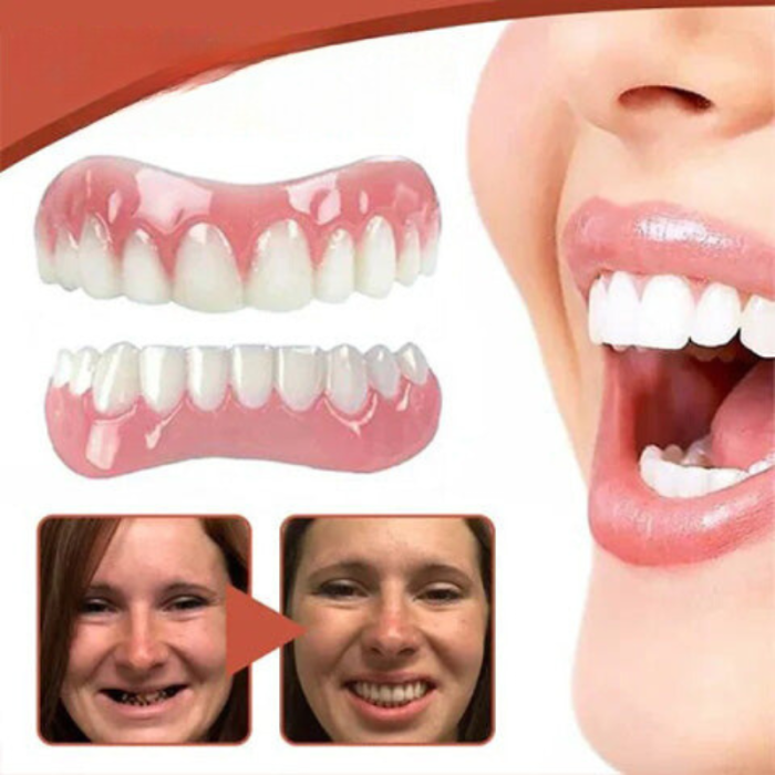 silicone-denture-reline-kit-4-1